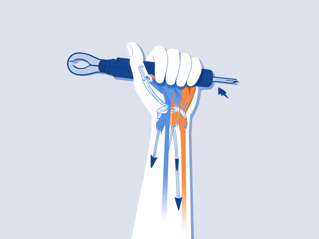 hand_anatomy_diagram_showing_wrist_flexion_during_overhead_work